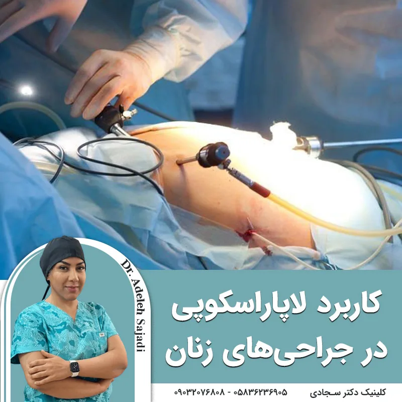 کاربرد لاپاراسکوپی در جراحی های زنان