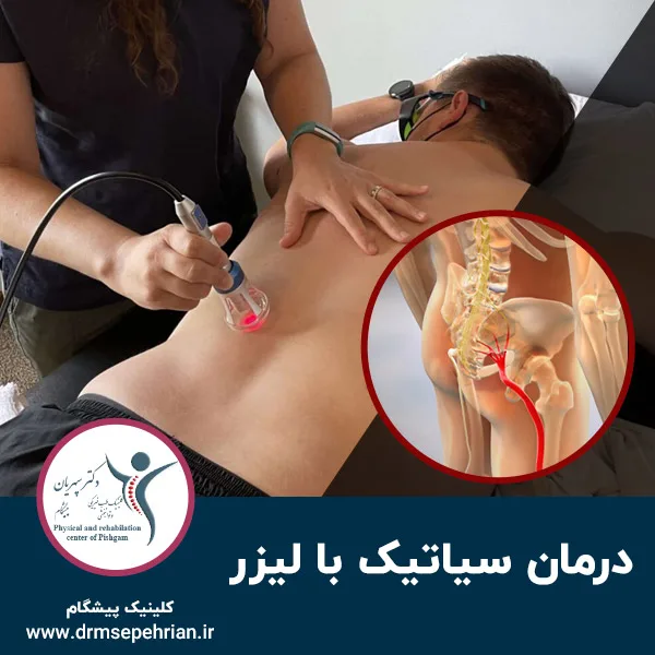 درمان سیاتیک با لیزر