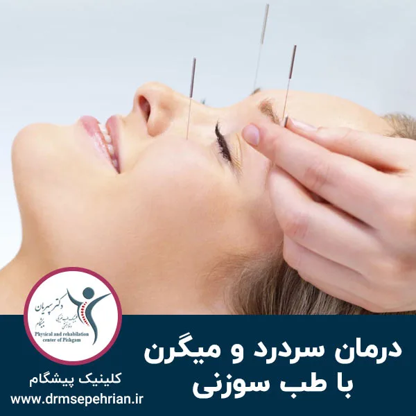درمان سردرد و میگرن با طب سوزنی