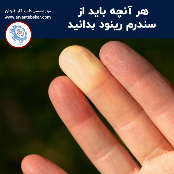 هر آنچه باید از سندرم رینود بدانید