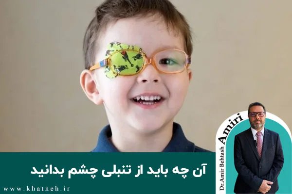 آن چه باید از تنبلی چشم بدانید