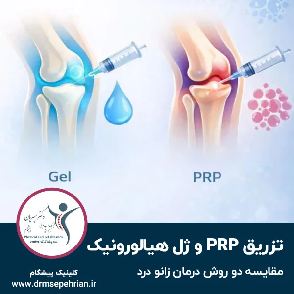 تفاوت تزریق PRP و ژل هیالورونیک در درمان زانو درد