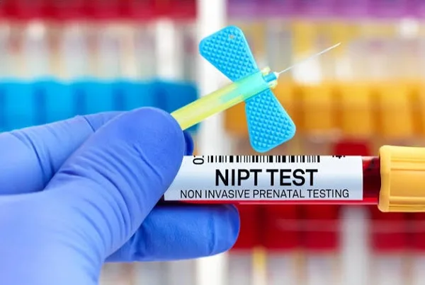 آزمایش سلفری یا NIPT
