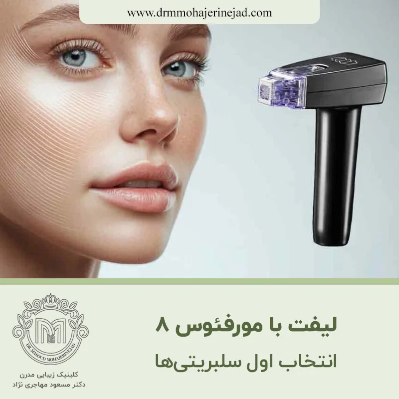 لیفت با دستگاه مورفئوس ۸؛ انتخاب اول سلبریتی ها