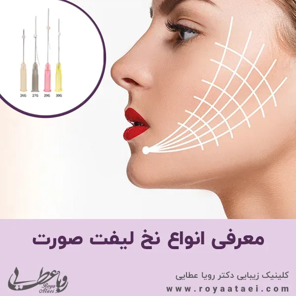 معرفی انواع نخ لیفت صورت