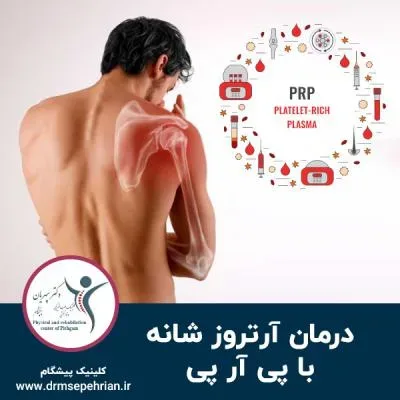 درمان آرتروز شانه با پی آر پی