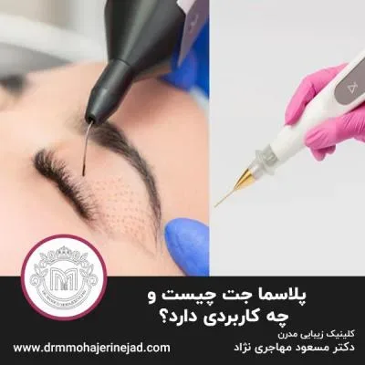 پلاسما جت چیست و چه کاربردی دارد؟