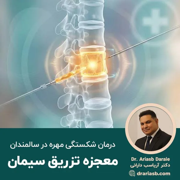 درمان شکستگی مهره در سالمندان؛ معجزه تزریق سیمان