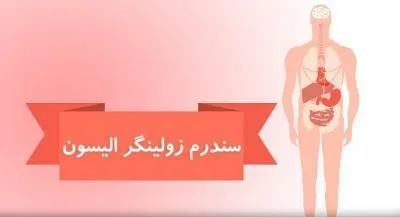 سندرم زولینگر – الیسون