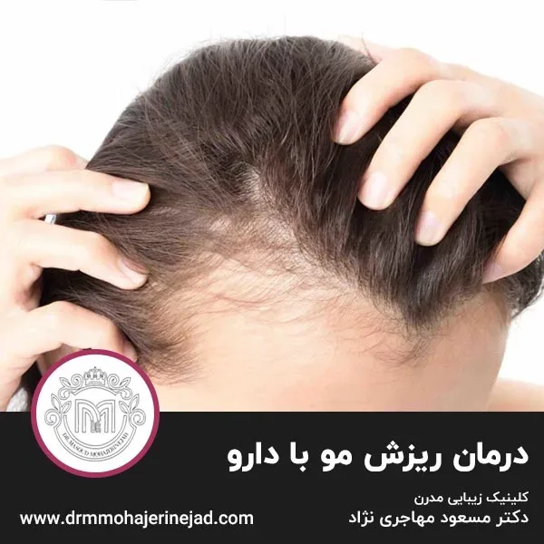 درمان ریزش مو با دارو