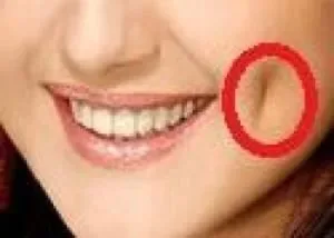 یک جراحی زیبایی عجیب و نوظهور در ایران