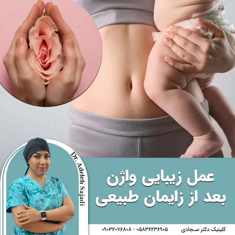 عمل زیبایی واژن بعد از زایمان طبیعی