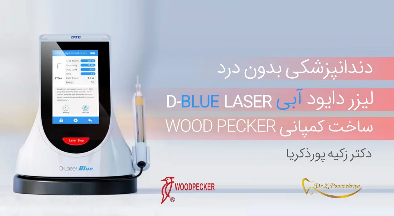 دندانپزشکی بدون درد با لیزر دایود آبی