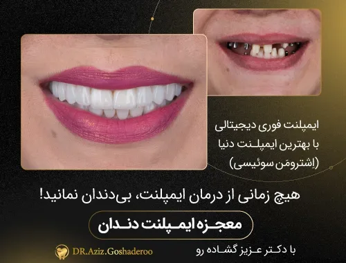 بهترین دندانپزشک تهران باید چه ویژگی‌هایی داشته باشد؟