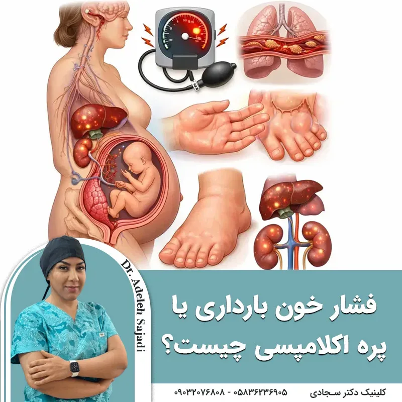 فشار خون بارداری یا پره اکلامپسی چیست؟