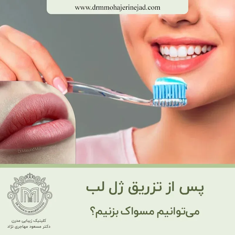 آیا پس از تزریق ژل لب می توانیم مسواک بزنیم؟