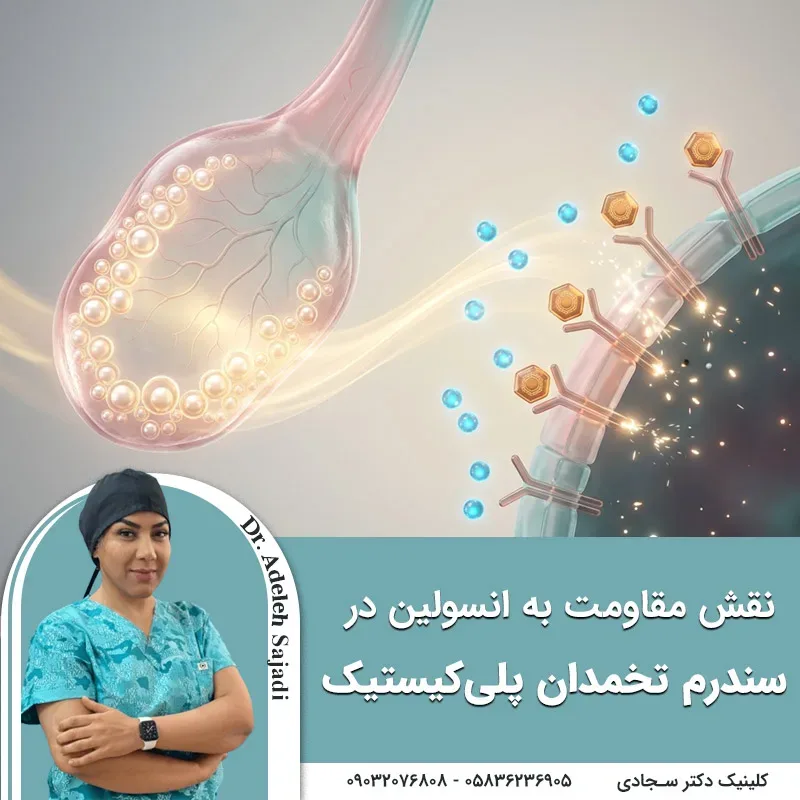 نقش مقاومت به انسولین در سندرم تخمدان پلی کیستیک