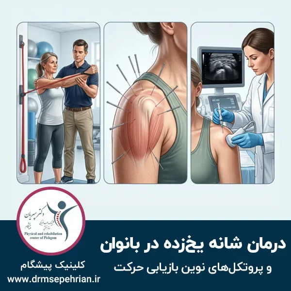 درمان شانه یخ زده در بانوان و پروتکل‌های نوین بازیابی حرکت