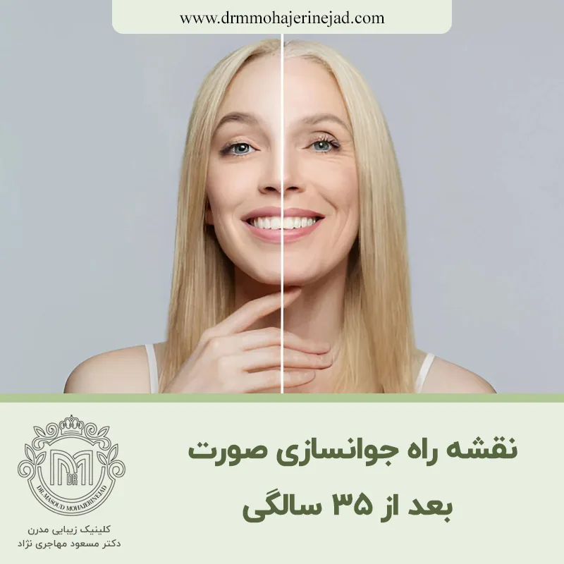نقشه راه جوانسازی صورت بعد از ۳۵ سالگی